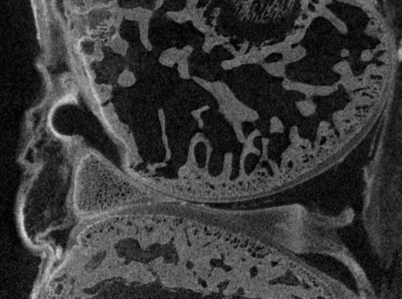 MicroCT image of mouse knee