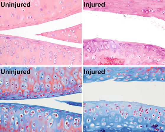 Histology image of injured cartilage