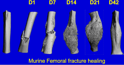 Photo: Fracture Biology