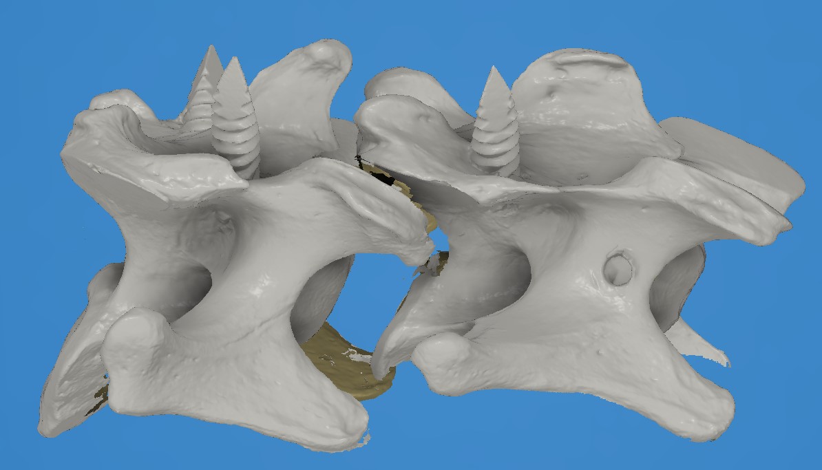 Canine Vertebra 3D scan