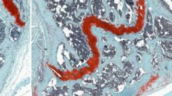 Bone and Cartilage Cell and Molecular Biology